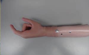 prosthetic 2