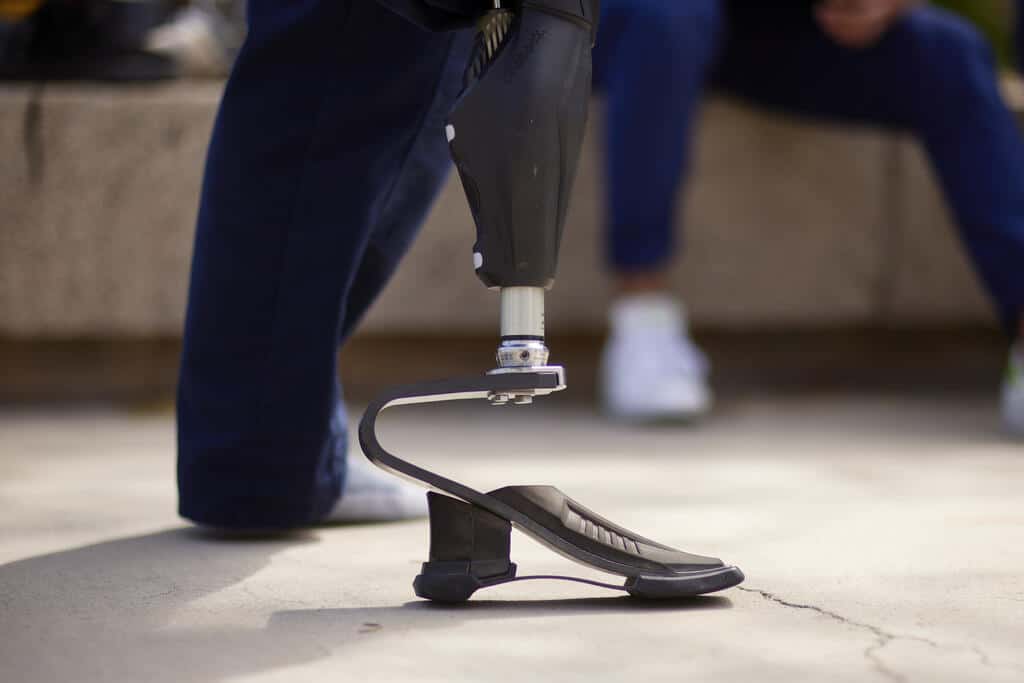 Person using a lower limb prosthesis.