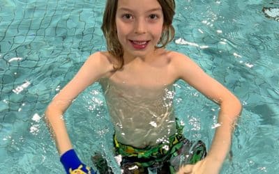 Swimmer Gets a Boost From Prosthetic Hand Device