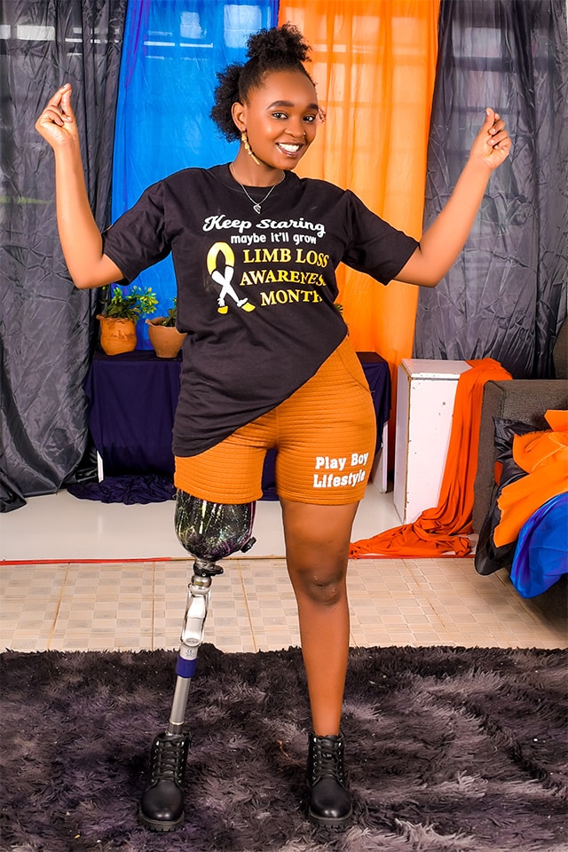 Consolata Waitherero wearing limb loss awareness t-shirt and shorts proudly displaying her prosthetic leg.