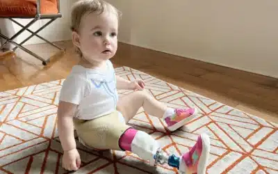 Gerber Baby Increases Awareness of People With Limb Differences