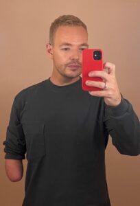White male with blonde hair takes a selfie. He has a limb difference on his right arm.