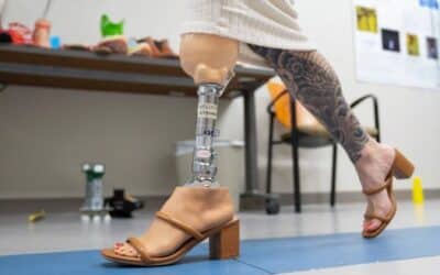 National Study Evaluates Connection Between Prosthetics and a Woman’s Identity