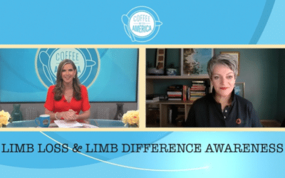 Cass Isidro Highlights Limb Loss and Limb Difference on Coffee with America